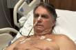 Bolsonaro segue sem movimentos intestinais há duas semanas e permanece na UTI