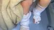 Bebê de 11 meses tem queimaduras de 2º grau após banho em escola no RS